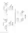 Fig. 12 - Orthognathic biomechanical simulation