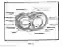 Fig. 07 - Deformable articulating templates