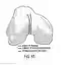 Fig. 49 - Deformable articulating templates