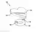 Fig. 01 - Orthodontic appliance