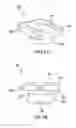 Fig. 03 - Orthodontic appliance