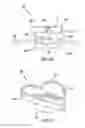 Fig. 04 - Orthodontic appliance