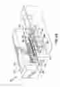 Fig. 06 - Orthodontic appliance