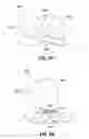 Fig. 11 - Orthodontic appliance