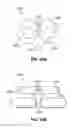 Fig. 12 - Orthodontic appliance
