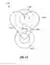 Fig. 13 - Orthodontic appliance