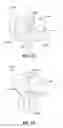 Fig. 15 - Orthodontic appliance