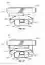 Fig. 16 - Orthodontic appliance