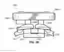 Fig. 17 - Orthodontic appliance