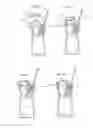 Fig. 09 - DENTAL TREATMENT CAPSULE, FORMULATION AND DEVICE