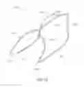 Fig. 02 - Dilating device for prostatic urethra