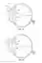 Fig. 09 - CAPSULAR MEMBRANE IMPLANTS TO INCREASE ACCOMMODATIVE AMPLITUDE