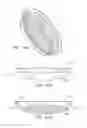 Fig. 35 - Accommodative intraocular lens