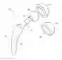 Fig. 01 - Coated hemi-prosthesis implant