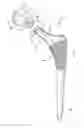 Fig. 01 - Modular taper seal for orthopaedic prosthetic hip assembly