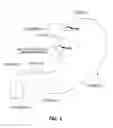 Fig. 02 - Endoscopic implant system and method