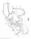 Fig. 03 - Airway assist device and method