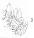 Fig. 07 - Airway assist device and method