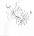 Fig. 10 - Airway assist device and method
