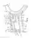 Fig. 13 - Airway assist device and method