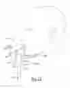 Fig. 20 - Airway assist device and method