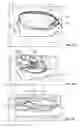 Fig. 04 - DECORATIVE CUSHION MASSAGE DEVICE