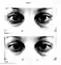 Fig. 02 - Luminate eye gel