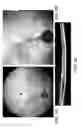 Fig. 04 - METHODS AND COMPOSITIONS FOR TREATMENT OF NEURODEGENERATIVE DISEASES