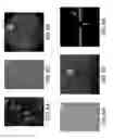 Fig. 07 - METHODS AND COMPOSITIONS FOR TREATMENT OF NEURODEGENERATIVE DISEASES