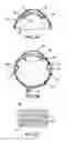 Fig. 03 - Ophthalmic drug delivery method