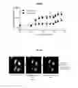 Fig. 10 - Autophagy Inhibitors