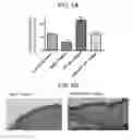 Fig. 06 - Goblet cell replacement therapy