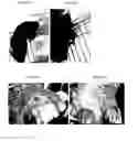 Fig. 04 - WOUND HEALING COMPOSITION