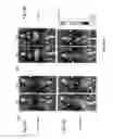 Fig. 14 - PHARMACOLOGICALLY INDUCED TRANSGENE ABLATION SYSTEM