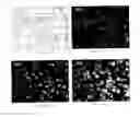 Fig. 07 - A MICELLAR PARTICLE