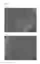 Fig. 09 - Revascularization graft material