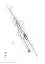 Fig. 15 - Catheter assembly