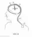 Fig. 08 - System and method for independently operating multiple neurostimulation channels