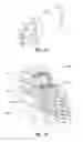 Fig. 28 - Implantable device header and method