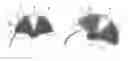 Fig. 01 - Method for operating a device for treatment of a tissue and device for treatment of a tissue