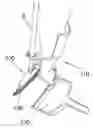 Fig. 01 - Versatile extension grip
