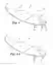 Fig. 02 - Method of making surf fin including injection molded pre-impregnated composite fiber matrix inserts