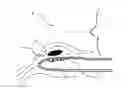Fig. 01 - Aircraft engine nacelle