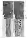 Fig. 02 - Methods of treating hedgehog-related diseases with an anti-LGR5 antibody