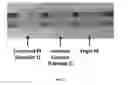 Fig. 04 - Method for purifying contaminated polyethylene