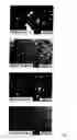 Fig. 02 - Glucamides In Syndet Soaps
