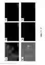 Fig. 02 - Method for harvesting stem and progenitor cells and method of treatment of kidney disease and neurological disease
