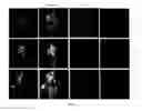 Fig. 02 - Generating cardiac progenitor cells from pluripotent stem cells using isoxazole or isoxazole like compounds