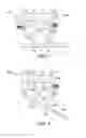 Fig. 06 - Turbine shroud with movable attachment features