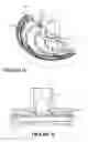 Fig. 07 - Blower for breathing apparatus